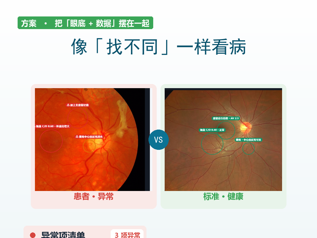 FDE实战:眼科眼底图片解读工具